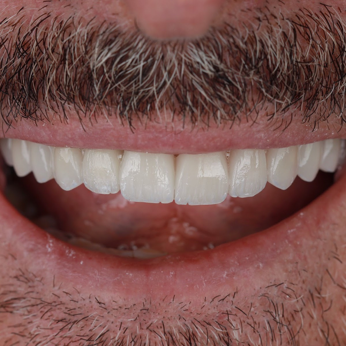 Temel Dental Polyclinic – Fotoğraf 4