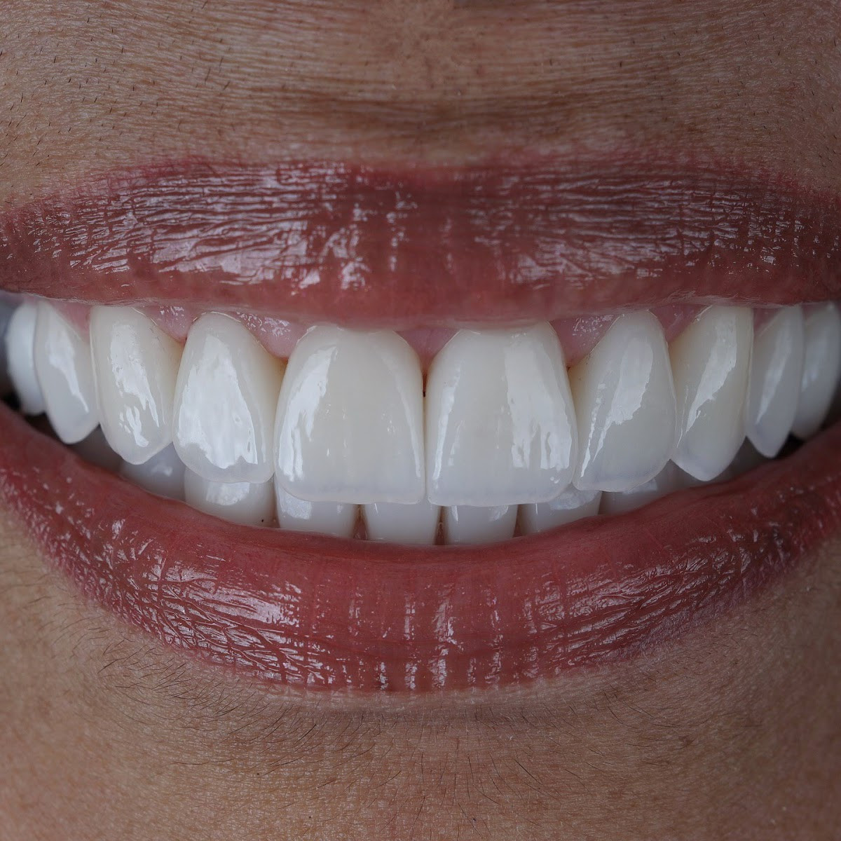 Temel Dental Polyclinic – Fotoğraf 5